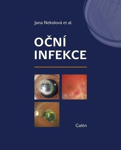 Kniha: Oční infekce - Jana Nekolová
