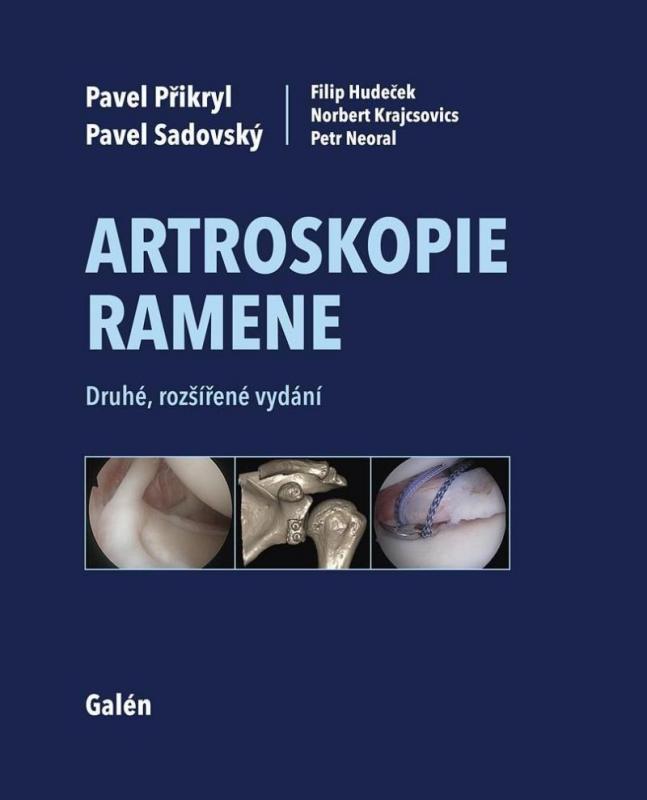 Kniha: Artroskopie ramenekolektív autorov