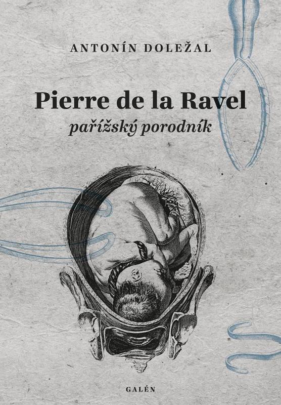 Kniha: Pierre de la Ravel, pařížský porodník - Doležal Antonín