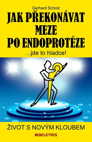 Kniha: Jak překonávat meze po endoprotéze - Život s novým kloubem - Scholz Gerhard