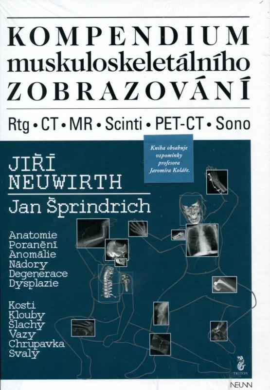 Kniha: Kompendium muskuloskeletálního zobrazování - Jiří Neuwirth
