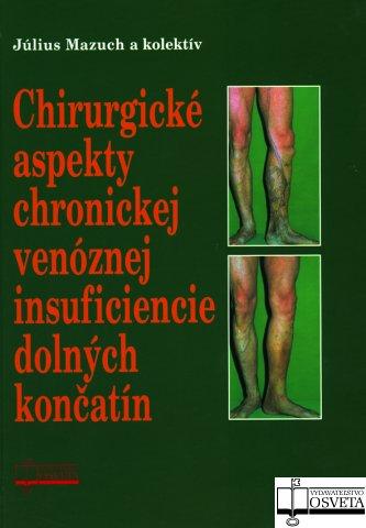 Kniha: Chirurgické aspekty chronickej venóznej insuficiencie dolných končatín - Július Mazúch a kol.