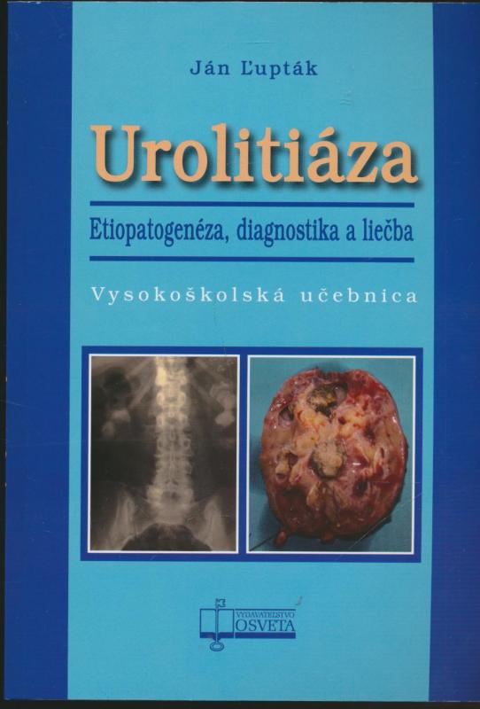 Kniha: Urolitiáza. Etiopatogenéza, diagnostika a liečba - Ján Ľupták