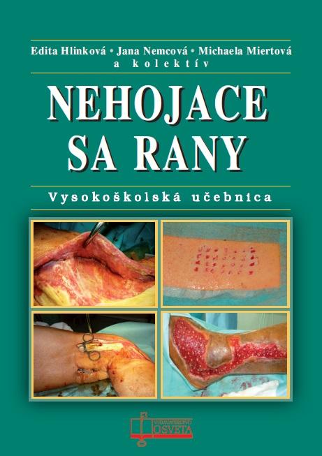 Kniha: Nehojace sa rany - Edita Hlinková