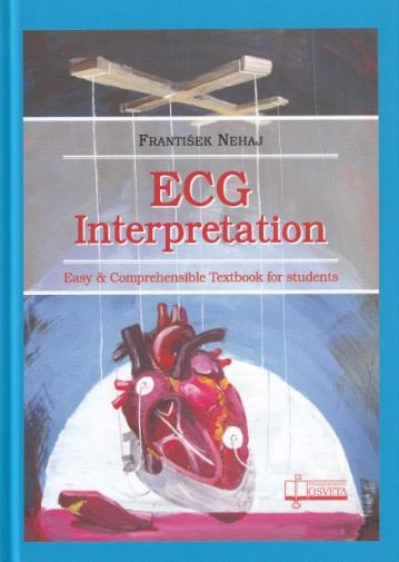 Kniha: ECG  - Interpretationautor neuvedený