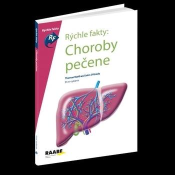 Kniha: Rýchle fakty : Choroby pečene - Kolektív autorov