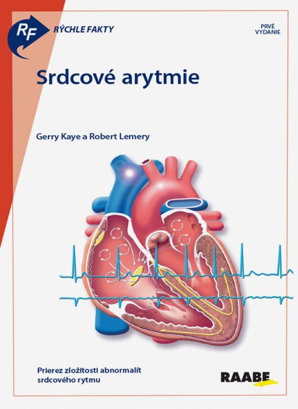 Kniha: Rýchle fakty : Srdcové arytmie - Kolektív autorov