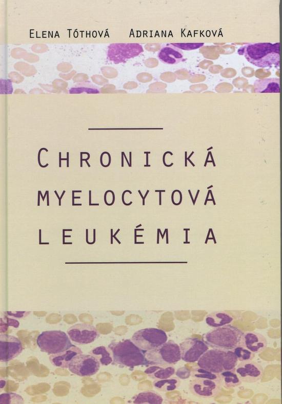 Kniha: Chronická myelocytová leukémia - Kafková, Elena Tóthová Adriana