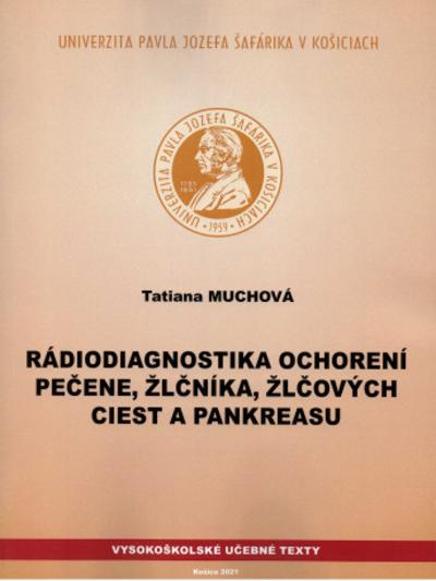 Kniha: Rádiodiagnostika ochorení pečene, žlčníka, žlčových ciest a pankreasu - Tatiana Muchová