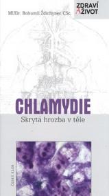 Chlamydie Skrytá hrozba v těle