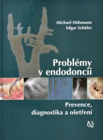 Problémy v endodoncii