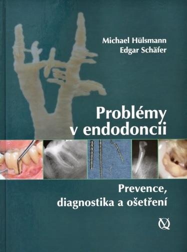 Kniha: Problémy v endodoncii - Michael Hülsmann