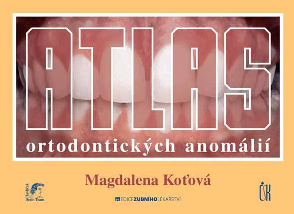 Kniha: Atlas ortodontických anomálií - Magdaléna Koťová