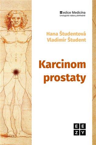 Kniha: Karcinom prostatyautor neuvedený