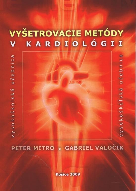 Kniha: Vyšetrovacie metódy v kardiológii - Valočik Gabriel, Peter Mitro