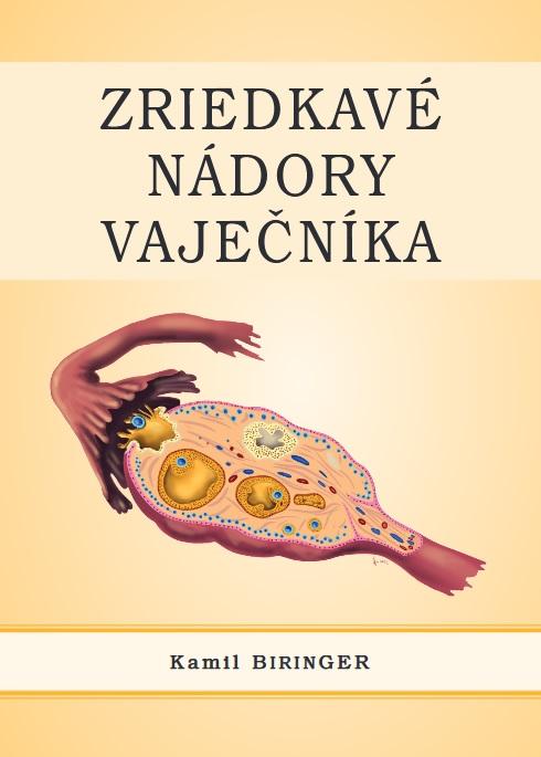 Kniha: Zriedkavé nádory vaječníka - Kamil Biringer