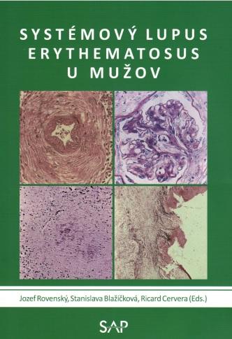 Kniha: Systemovy lupus erythematosus u muzov - Jozef Rovenský