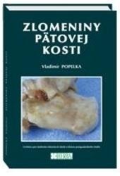 Kniha: Zlomeniny pätovej kosti - Vladimír Popelka