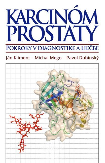 Kniha: Karcinóm prostaty - Ján Kliment