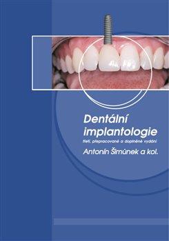 Kniha: Dentální implantologie, 3. přepracované a doplněné vydání - kolektiv autorů