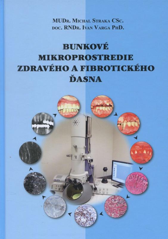 Kniha: Bunkové mikroprostredie zdravého a fibrotického ďasna - Michal Straka